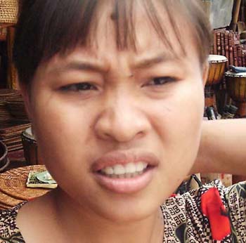 baliw25