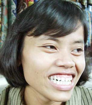 baliw29